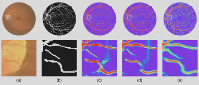 Example of retinal fundus image (a), ground-truth vessel segmentation, segmentation results by existing two methods (c, d), and our IterNet (e).